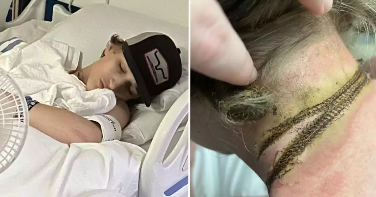 Teen Boy Barely Survives Terrifying Electrocution Incident Caused by Phone Charger