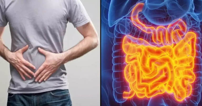 Seven Worrying Signs You Have an Unhealthy Gut Amid ‘Disturbing’ Cancer Surge in People Under 50