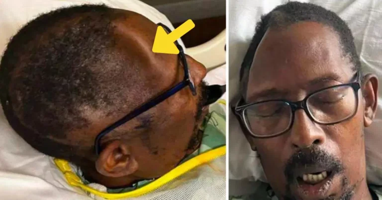 Couple Sues Hospital After It ‘Loses 12×15 cm Piece of His Skull’ During Surgery and Charges $19,000 for Replacement