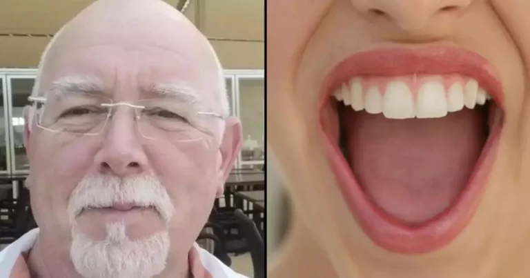 Cancer Survivor Urges Immediate Action—Don’t Ignore Unusual Mouth Symptoms