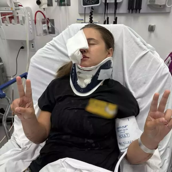 Teen injured in a low-speed car crash suffering from a traumatic eye injury, awaiting recovery.