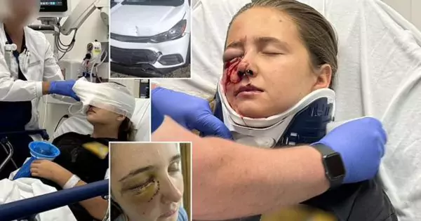 Teen injured in a low-speed car crash suffering from a traumatic eye injury, awaiting recovery.